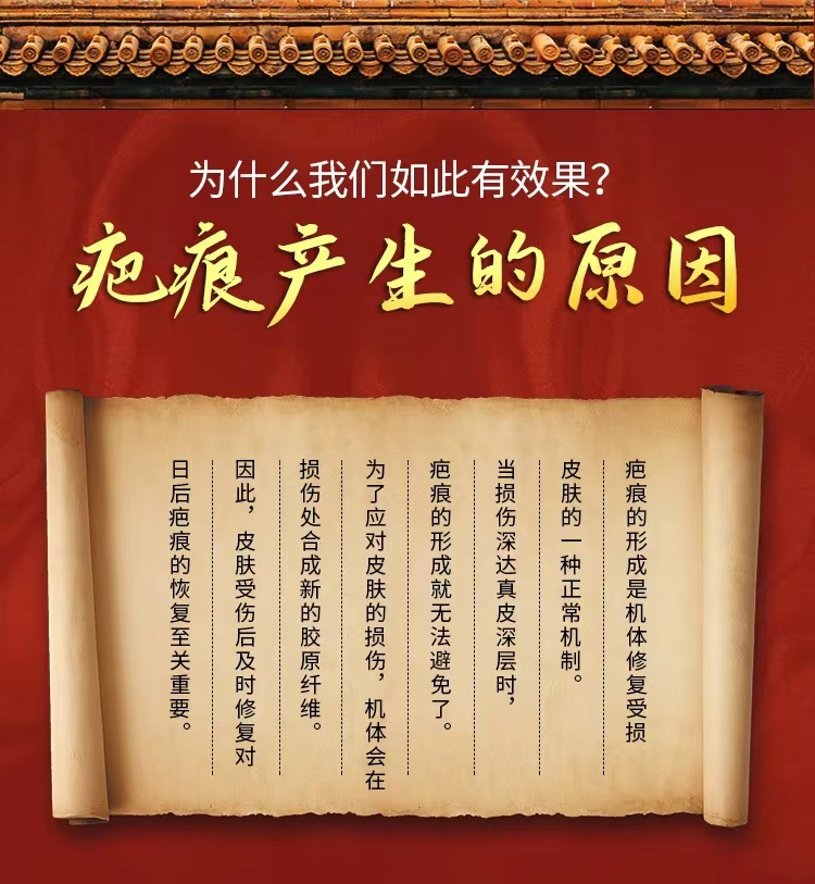 祛疤膏深层祛疤快速见效源头厂家 舜易康药业祛疤膏OEM代加工